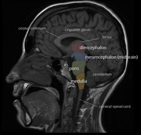 Brainstem reflexes | STROKE MANUAL