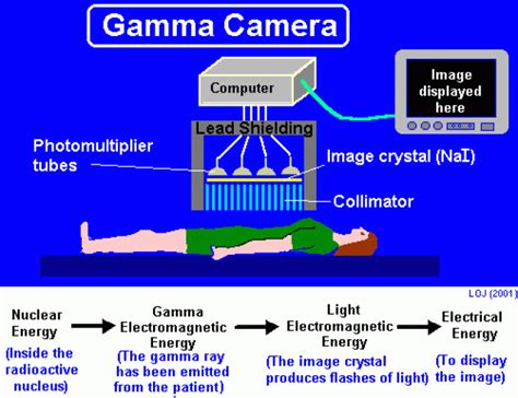 Gamma Camera History | The Evolution of Medical Imaging Technology