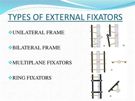 External, internal fixation, DCP and Cast Syndrome