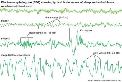 What Are The Possible Causes For An Abnormal Eeg: Unraveling The Brains ...