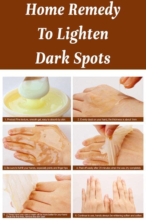 12 Liver spot ideas | liver spot, dark spots on skin, beauty skin