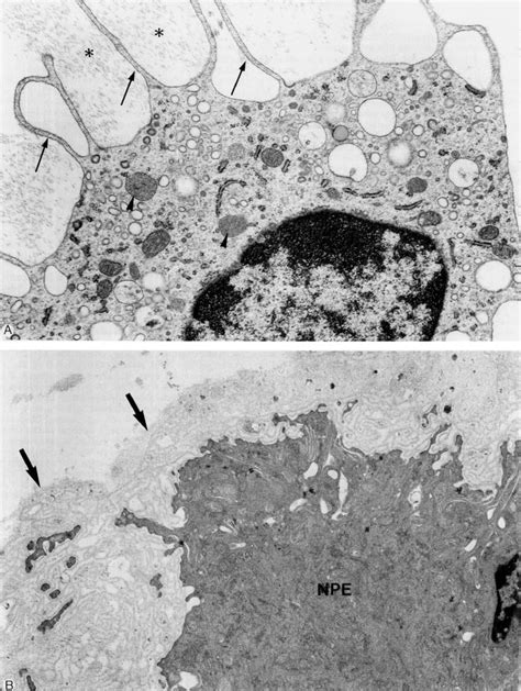 A Between the zonular fibers (asterisks) of the pars plana and the ...