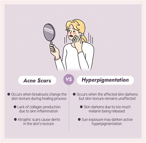 Acne scars vs. hyperpigmentation