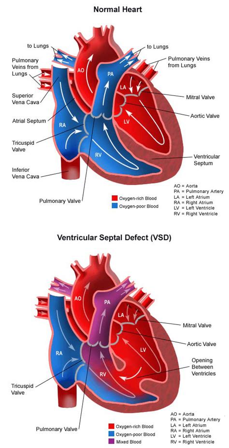 Ventricular Septum Parts