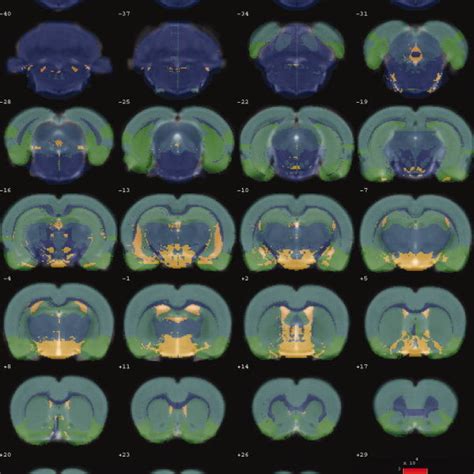 (PDF) A Rat Brain MRI Template with Digital Stereotaxic Atlas of Fine ...