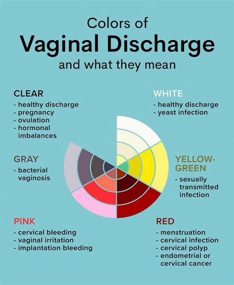 Is it really a YEAST INFECTION or OVULATION? – Nett Pharmacy Limited