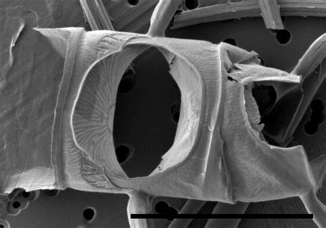 Image Chaetoceros-constrictus-SEM1.jpg | Species - Diatoms of North America