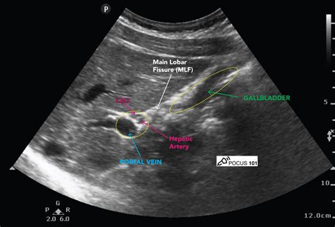 Abdominal Ultrasound Made Easy: Step-By-Step Guide - POCUS 101