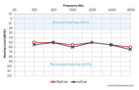 How to read an audiogram