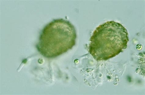 Protist Images: Difflugia pristis