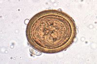 Echinococcus granulosus, ova in faeces of dog w.m. – Instruments Direct