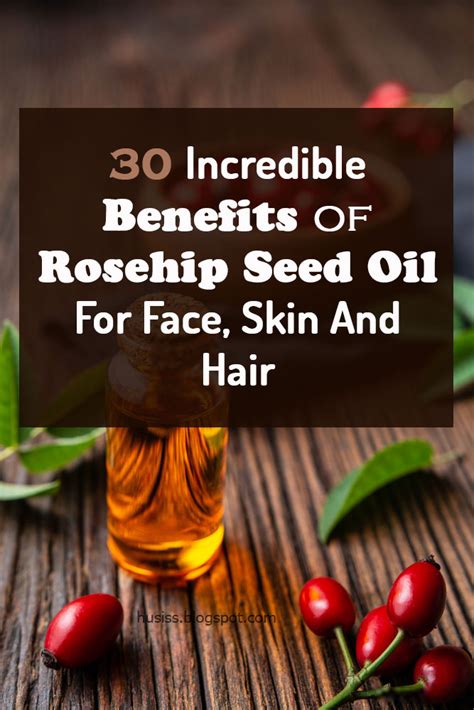 30 Incredible Benefits of Rosehip Seed Oil For Face, Skin And Hair in ...