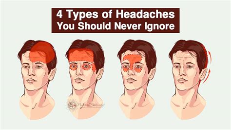 diagram: 4 Types of Headaches You Should Never Ignore