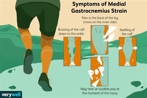 Medial Gastrocnemius Strain