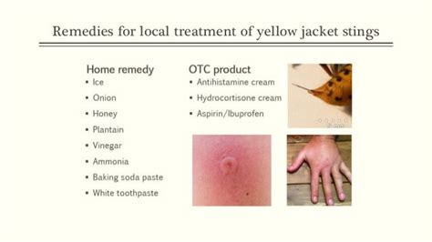 Yellow jacket sting: Inflammation and natural remedy