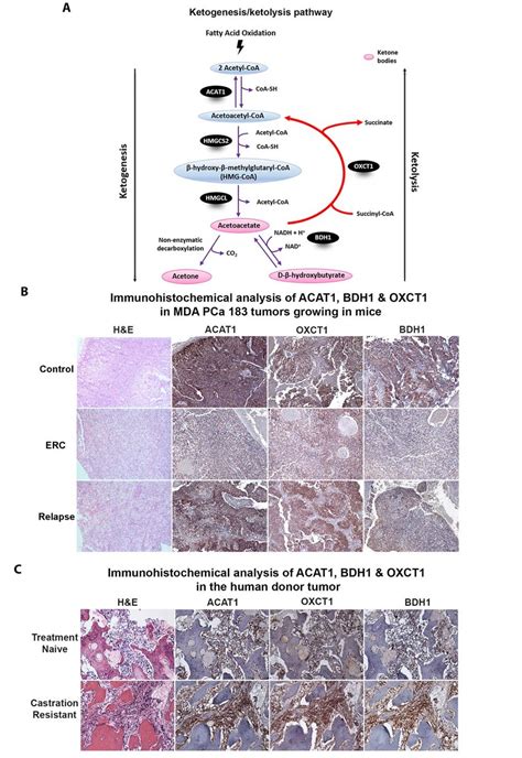 Upregulation of ketogenic/ketolytic enzymes in preclinical and clinical ...