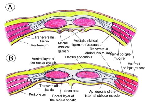 Transverse sections of the anterior abdominal wall. (A) Below the ...