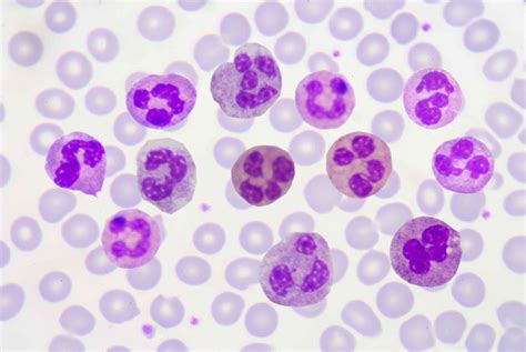 Polymorphonuclear Leukocytes White Blood Cells