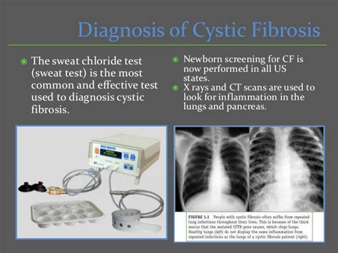 The Truth about Cystic Fibrosis