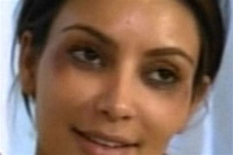 Kim actually paid someone to give her these black eyes - Mirror Online