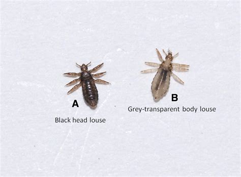 SoCal area, not sure if lice or not. Thanks for your help! : r/whatsthisbug