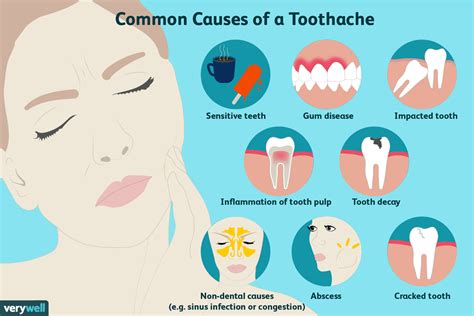 Tooth Pain: Causes, Treatment, When to See a Dentist (2022)