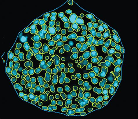 An Optimized High-Content Imaging Workflow for 3D Spheroid Cell Models