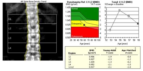 CP Advanced Imaging | Bone Densitometry