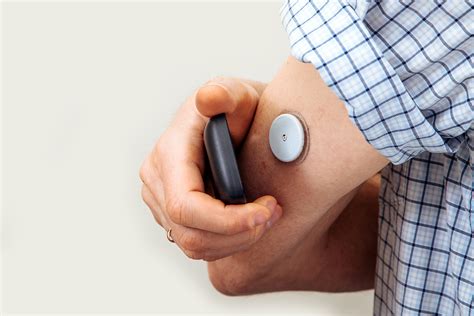 Continuous Glucose Monitoring: Evolving Evidence for Technology - MCG ...