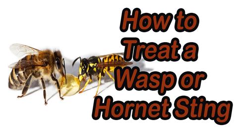 How to Treat a Wasp or Hornet Sting- Treat Hornet Wasp Sting | Healthy ...