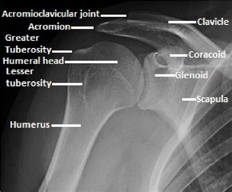 Greater Tubercle Of Humerus