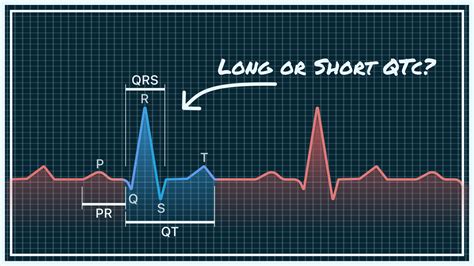 Qtc Normal Range