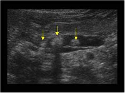 Abdomen and retroperitoneum | 1.3 Pancreas : Case 1.3.7 Pancreas ...