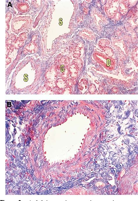 Histology of the Nasal Septal Swell Body (Septal Turbinate) | Semantic ...