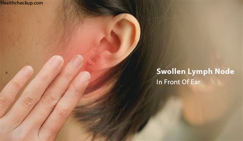 Swollen Lymph Node In Front of Ear - Causes, Treatment, Home Remedies