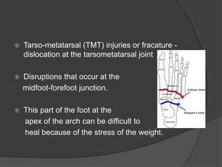 Lisfranc injury | PPT