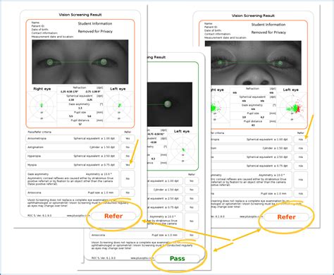 Understanding Your Results