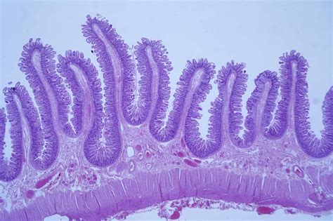 What Is Histopathology Small Test: Unveiling The Basics