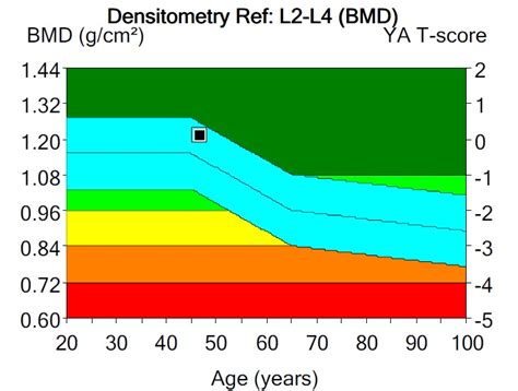 Bone density results - St Vincent's Clinic Densitometry