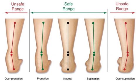 What is Underpronation? Running Pronation Explained