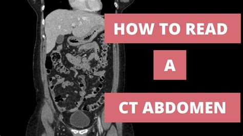 How to read a CT Abdomen for Med students and Residents - Part 1 - YouTube