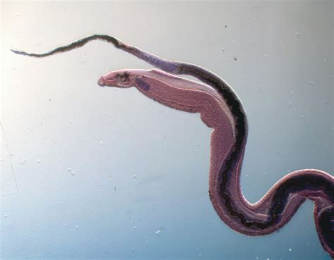 Schistosoma Mansoni Photograph by Eye of Science - Pixels