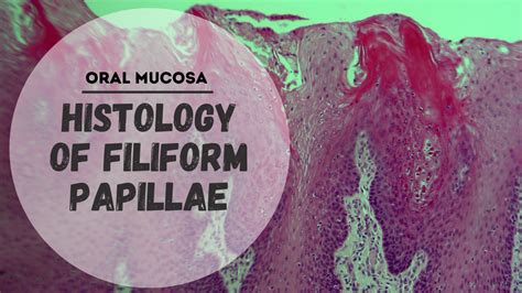 Histology of Specialized Mucosa | Filiform papillae | Dentistry ...