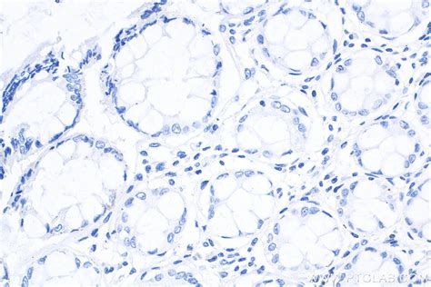 Mouse IgG2b isotype control antibody (66360-3-Ig) | Proteintech