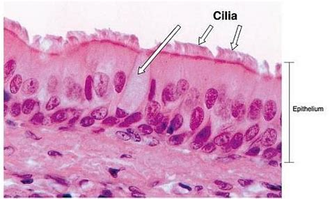 Columnar Epithelium Labeled