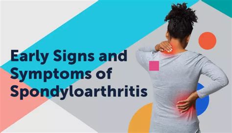 Early Symptoms of Spondylitis | MySpondylitisTeam