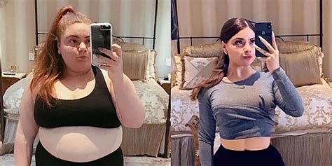 Inspiring Gastric Sleeve Success Stories (Videos)