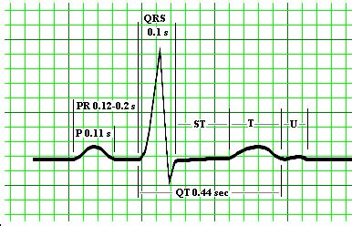 Micro EKG - Mad Scientist Software