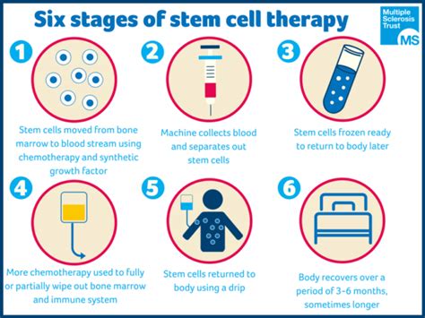 Read Latest News - Stem Cell Transplant Effective for Select MS Patients.