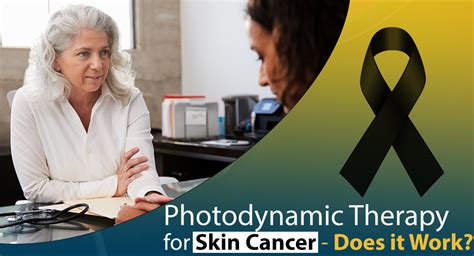 How Photodynamic Therapy Treats Skin Cancer